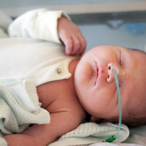 Nasogastric Feeding Practical Training